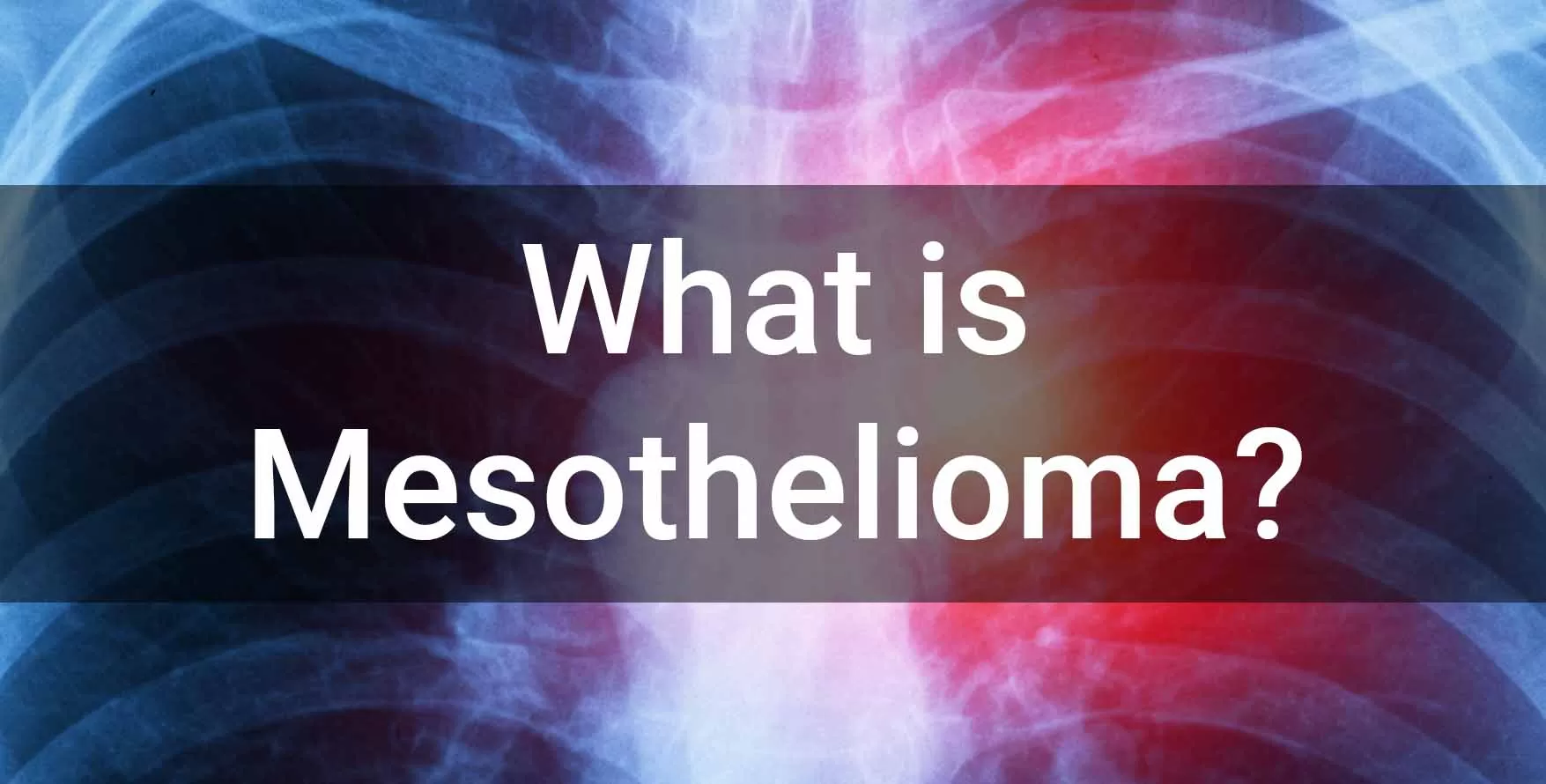 mesothelioma